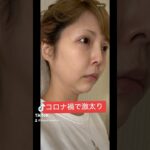 2024年　私のこの2年間。ダイエットしてもシミや劣化が…。グリーンピールに出会って、お肌ツルツル✨ #美容 #グリーンピール5days #劣化　#ダイエット　#仰天ニュース #beforeandafter