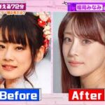 2024年　整形に全財産を投資！？なりたかったかわいい自分！福岡みなみの整形事情｜『ななにー 地下ABEMA』毎週日曜よる8時〜ABEMAで無料放送中