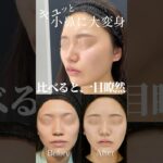 2024年　バレない鼻整形、叶えます！#shorts#鼻整形#美容整形
