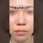2024年　ご希望：ちいさくてかわいい鼻#shorts #鼻整形 #ちいかわ #美容 #垢抜け #美容整形