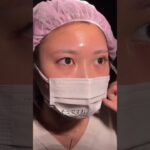 2024年　【二重整形】他院で断られ…二重整形密着物語　#shorts