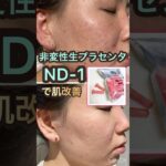 2024年　【一味違うプラセンタで肌改善】#プラセンタ　#肌改善　#ほうれい線 #毛穴　#リセラ　#乾燥　#高濃度美容液