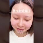 2024年　【整形】お人形みたいになりたい#新宿 #美容整形 #二重 #二重整形